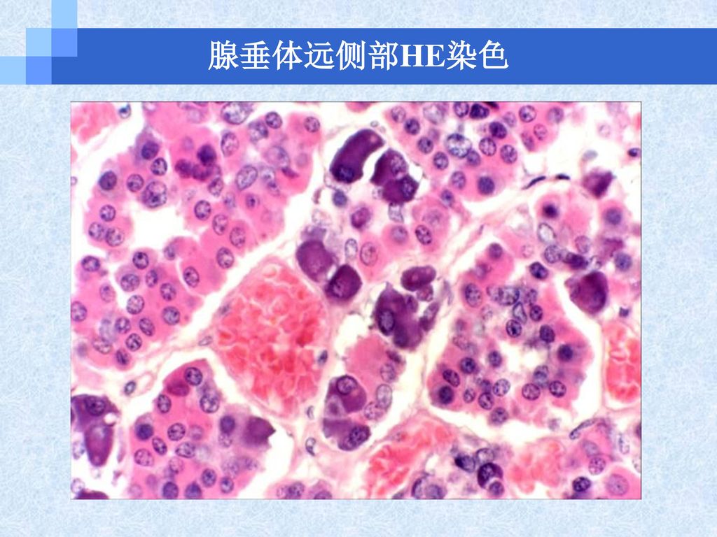 (一)腺垂体(adenohypophysis) 1,远侧部(pars distalis)腺细胞排列成