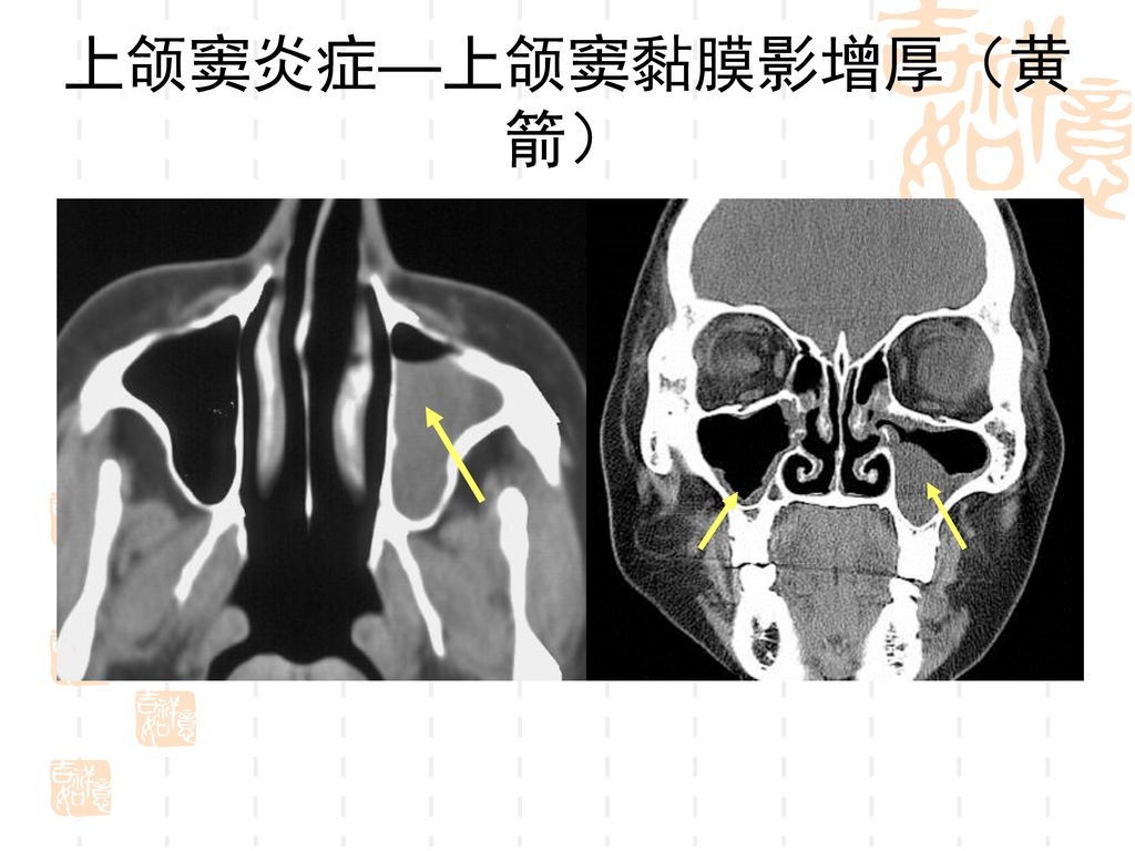 石河子大学医学院第一附属医院ct&mri室