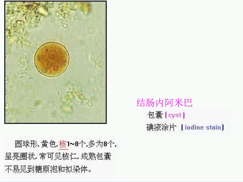 阿米巴性肠组织溃疡 肠粘膜下阿米巴脓肿 肠壁组织内可见阿米巴滋养