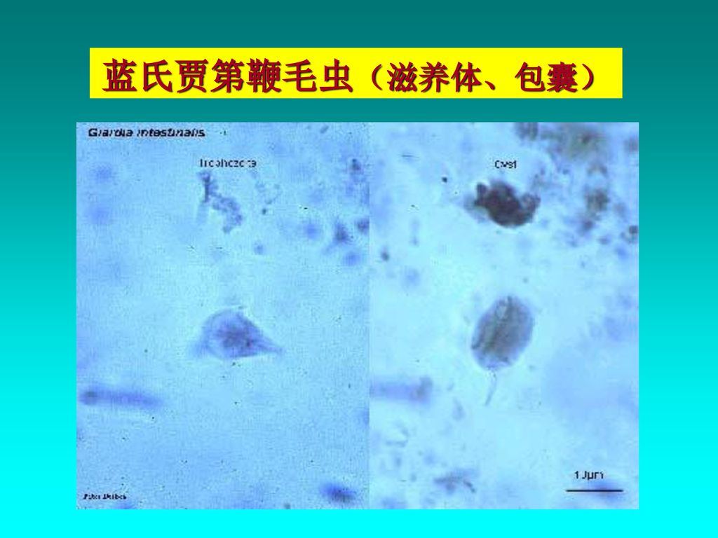 67                贾第虫感染的诊断诊断粪检包囊(碘染)滋养体