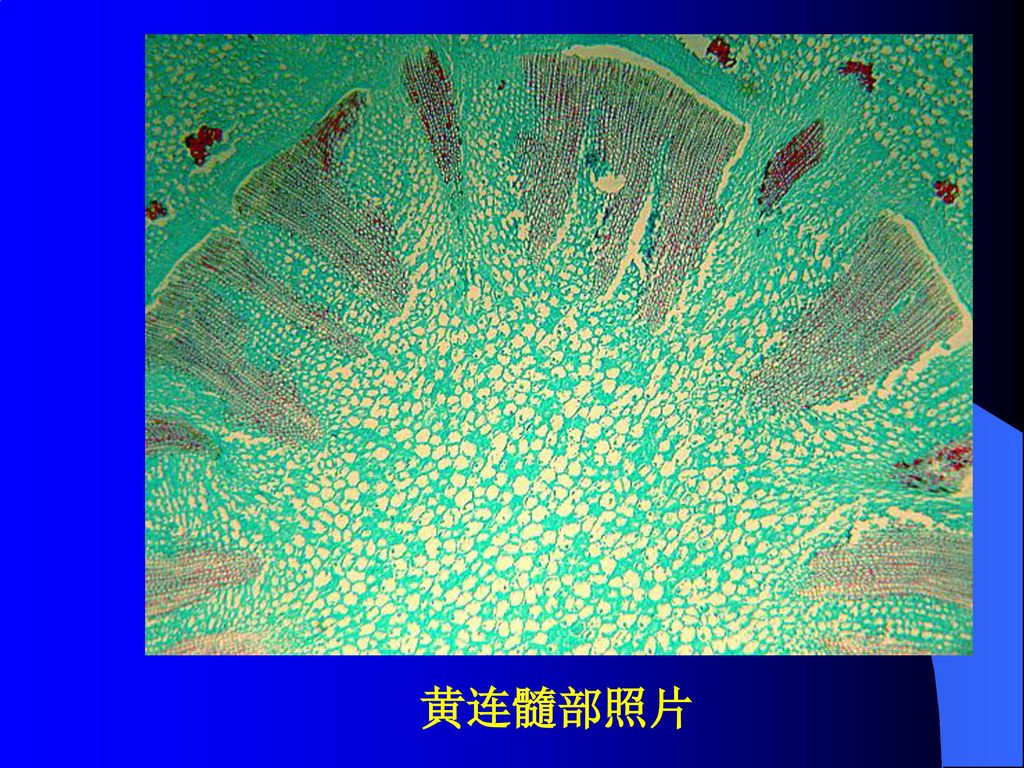 石细胞4皮层5根迹维管束 6中柱鞘纤维 7韧皮部8形成层9木质部10髓显微