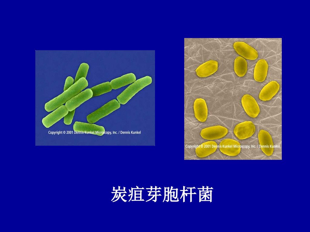 产气荚膜梭菌肉毒梭菌破伤风梭菌 炭疽芽胞杆菌