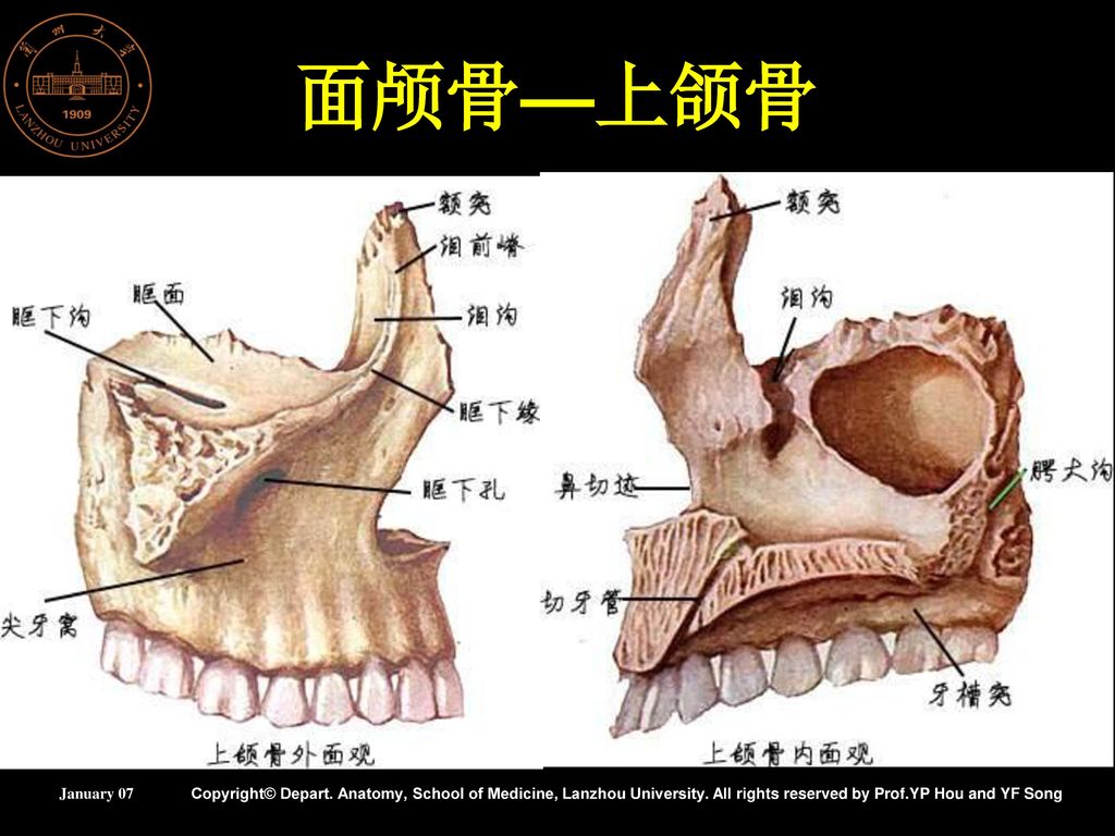 面颅骨—上颌骨 成对,构成颜面的中央部,可分为 一体四突: 上颌体 额