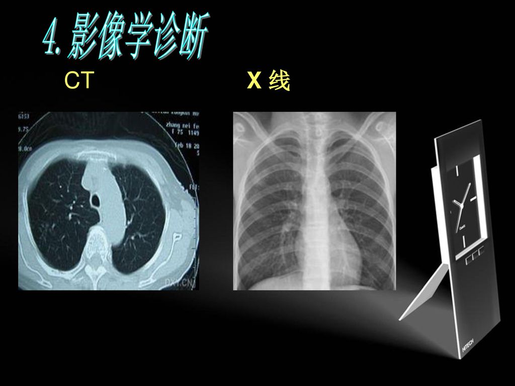 特别是麻疹,百日咳5) 有无结核过敏表现:结节性红斑,疱疹性结膜炎2