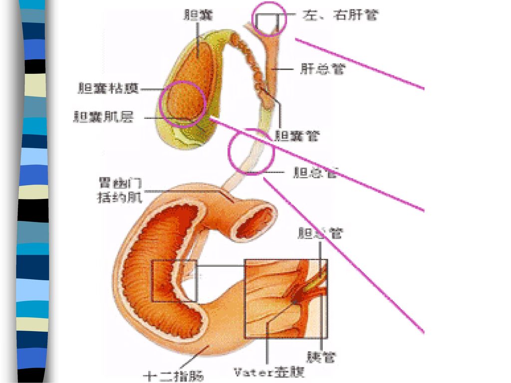 教学要求 掌握: 夏柯氏(charcot)三联征的定义,胆囊结石及急性胆囊炎