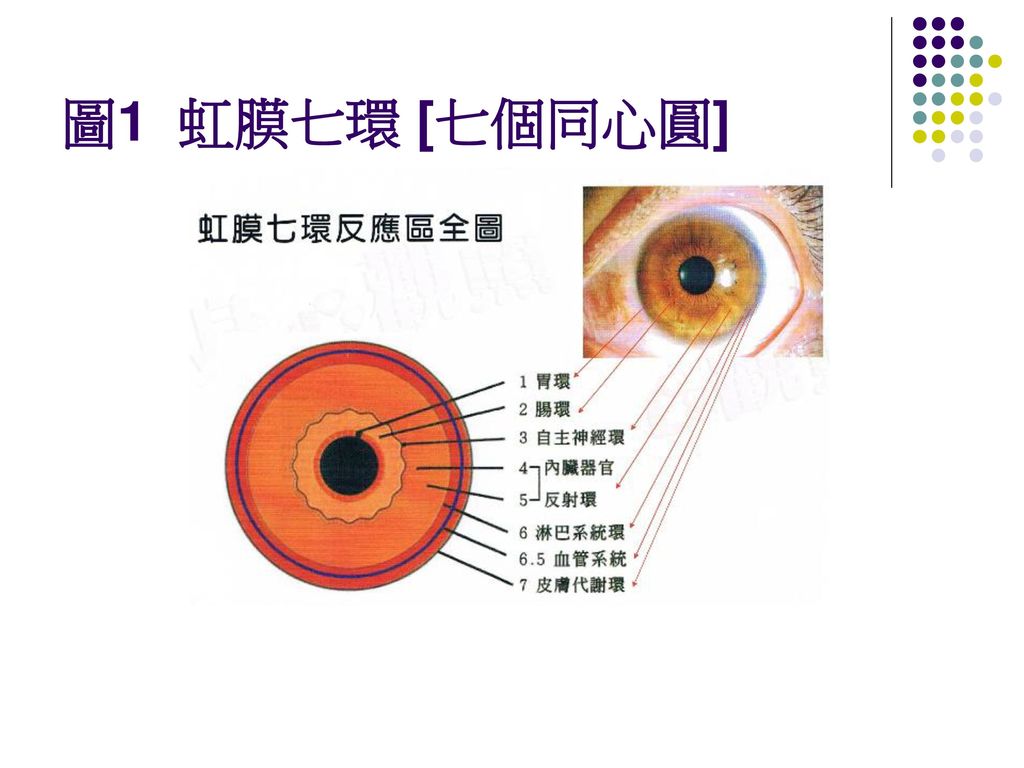 虹膜学与心血管疾病指标相关性之研究 研究生:林明杰