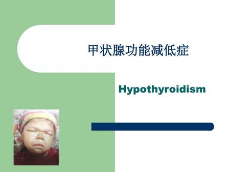 甲状腺功能减低症 Hypothyroidism.