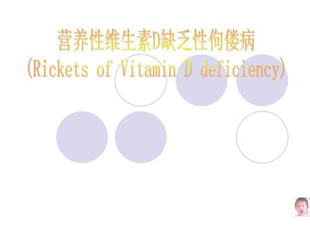 (Rickets of Vitamin D deficiency)