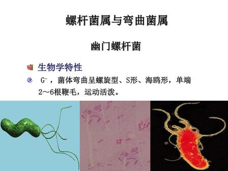 螺杆菌属与弯曲菌属 幽门螺杆菌 生物学特性 G- ，菌体弯曲呈螺旋型、S形、海鸥形，单端 2～6根鞭毛，运动活泼。