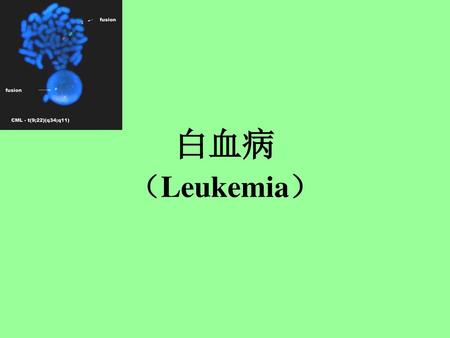 白血病 （Leukemia）.