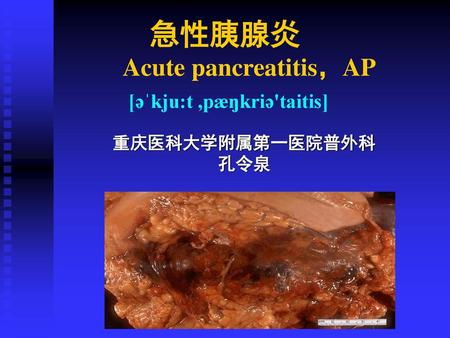 急性胰腺炎 Acute pancreatitis，AP [əˈkju:t ,pæŋkriə'taitis]