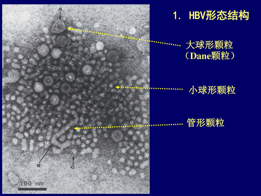 1. HBV形态结构 大球形颗粒（Dane颗粒） 小球形颗粒 管形颗粒