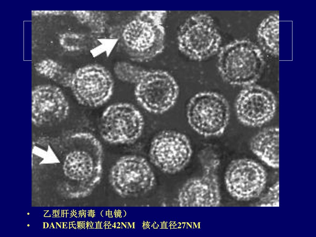 乙型肝炎病毒（电镜） DANE氏颗粒直径42NM 核心直径27NM