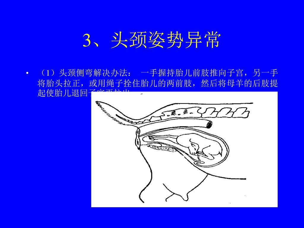 3、头颈姿势异常 （1）头颈侧弯解决办法： 一手握持胎儿前肢推向子宫，另一手将胎头拉正，或用绳子拴住胎儿的两前肢，然后将母羊的后肢提起使胎儿退回子宫再拉出。