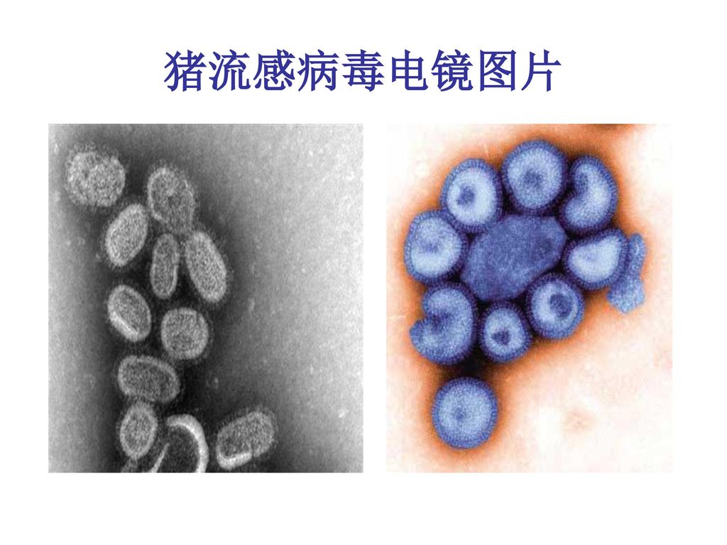 猪流感病毒电镜图片 来自美国CDC