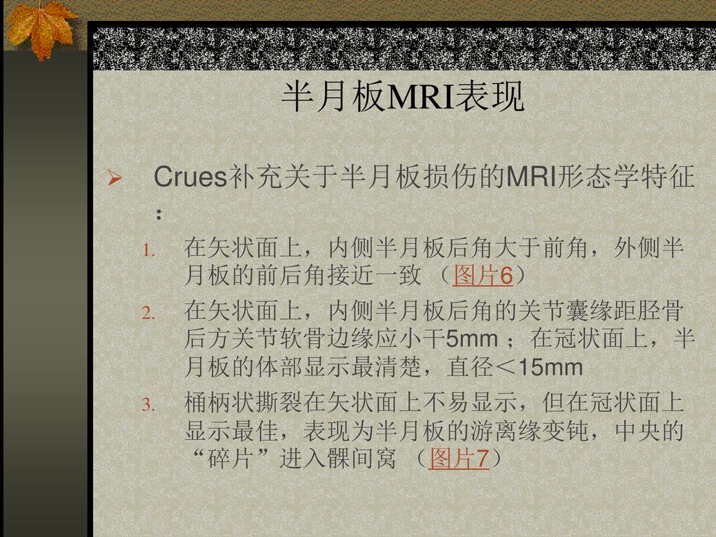 半月板MRI表现 Crues补充关于半月板损伤的MRI形态学特征：