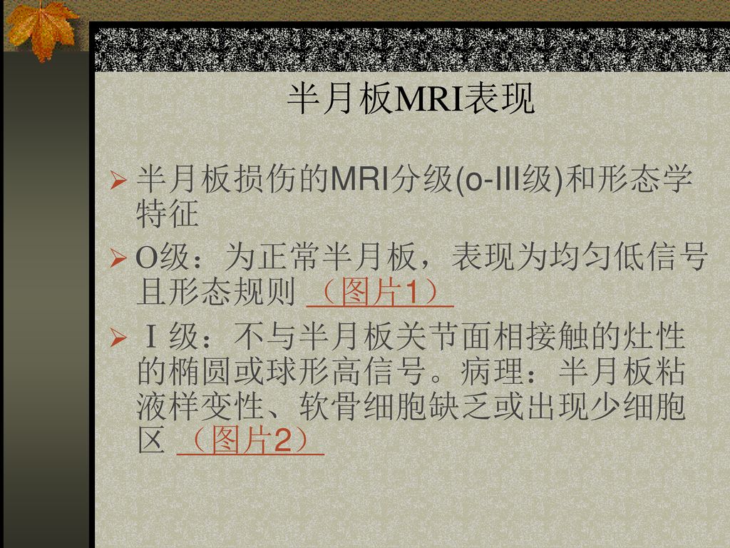 半月板MRI表现 半月板损伤的MRI分级(o-III级)和形态学特征 О级：为正常半月板，表现为均匀低信号且形态规则 （图片1）