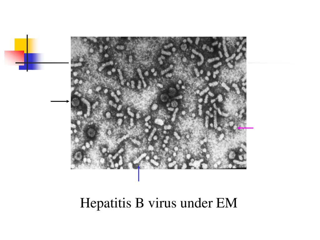 Hepatitis B virus under EM