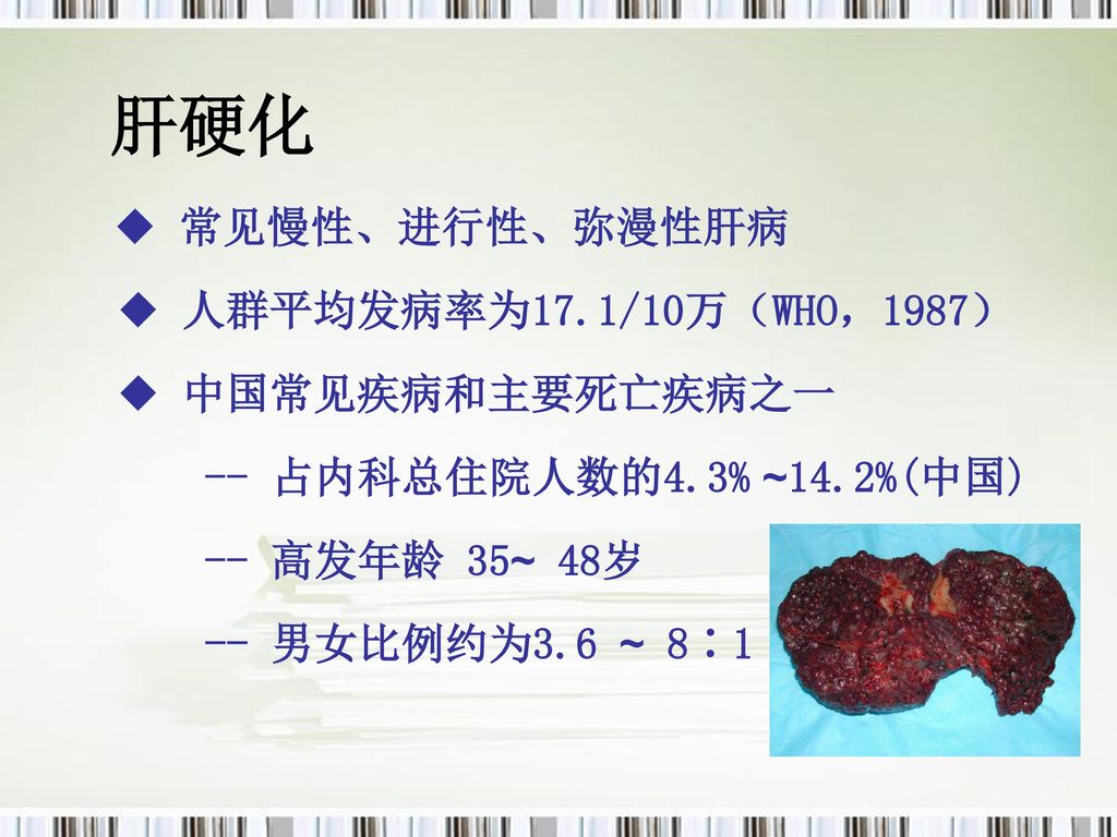 肝硬化 ◆ 人群平均发病率为17.1/10万（WHO，1987） ◆ 中国常见疾病和主要死亡疾病之一