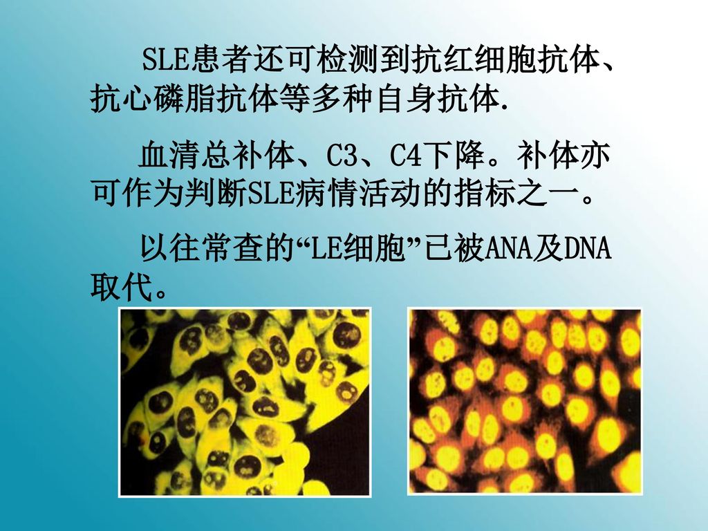 SLE患者还可检测到抗红细胞抗体、抗心磷脂抗体等多种自身抗体.