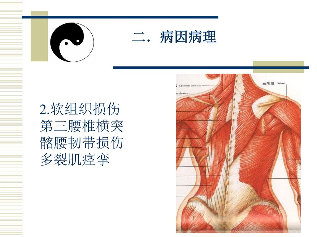 二．病因病理 2.软组织损伤 第三腰椎横突 髂腰韧带损伤 多裂肌痉挛