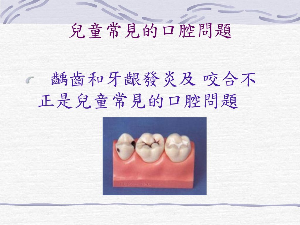 兒童常見的口腔問題 齲齒和牙齦發炎及 咬合不正是兒童常見的口腔問題