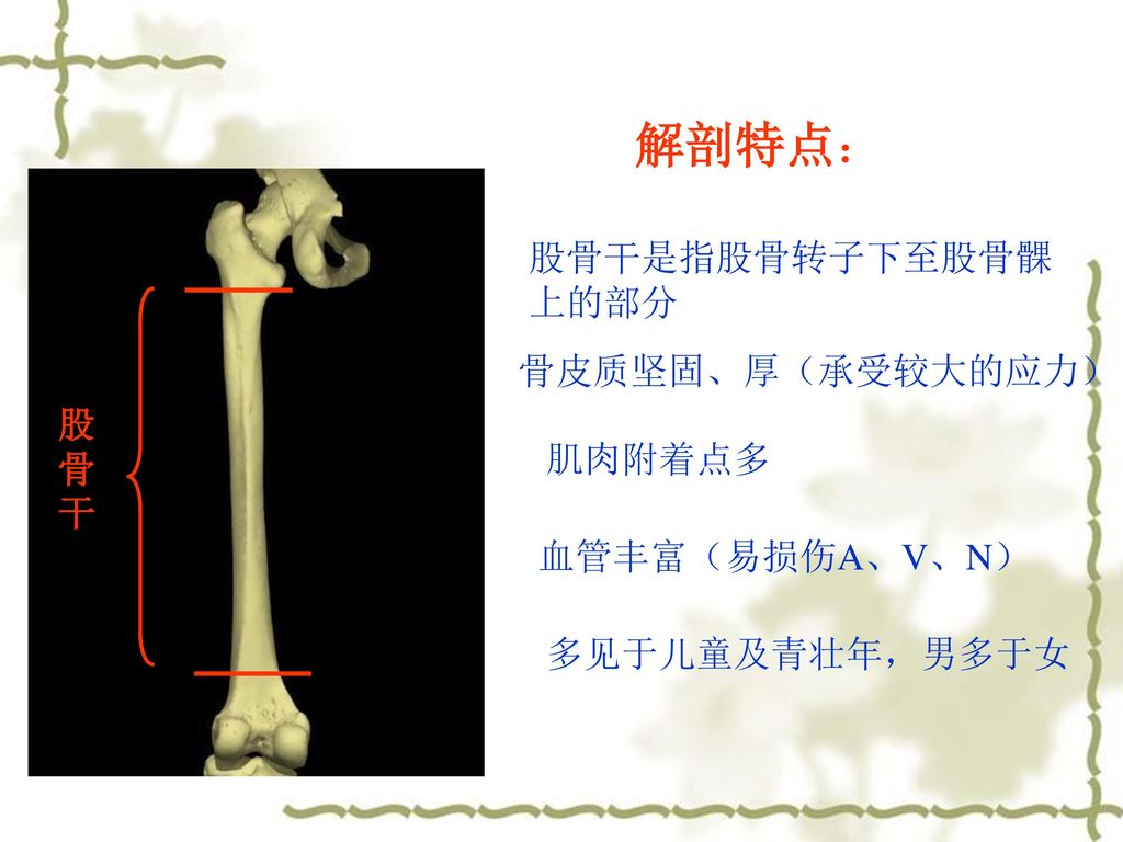 解剖特点： 股骨干是指股骨转子下至股骨髁上的部分 骨皮质坚固、厚（承受较大的应力） 股骨干 肌肉附着点多 血管丰富（易损伤A、V、N）