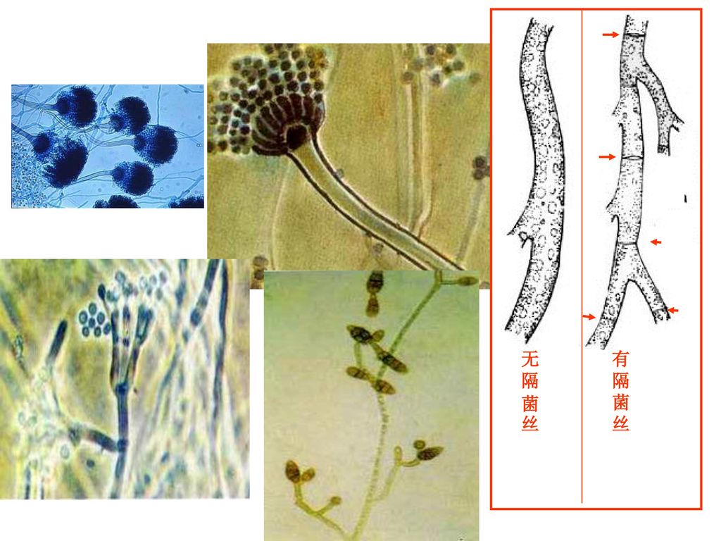 真菌:霉菌(丝状菌)菌 丝菌    丝:霉菌生长出的中空,细长的微管菌丝体