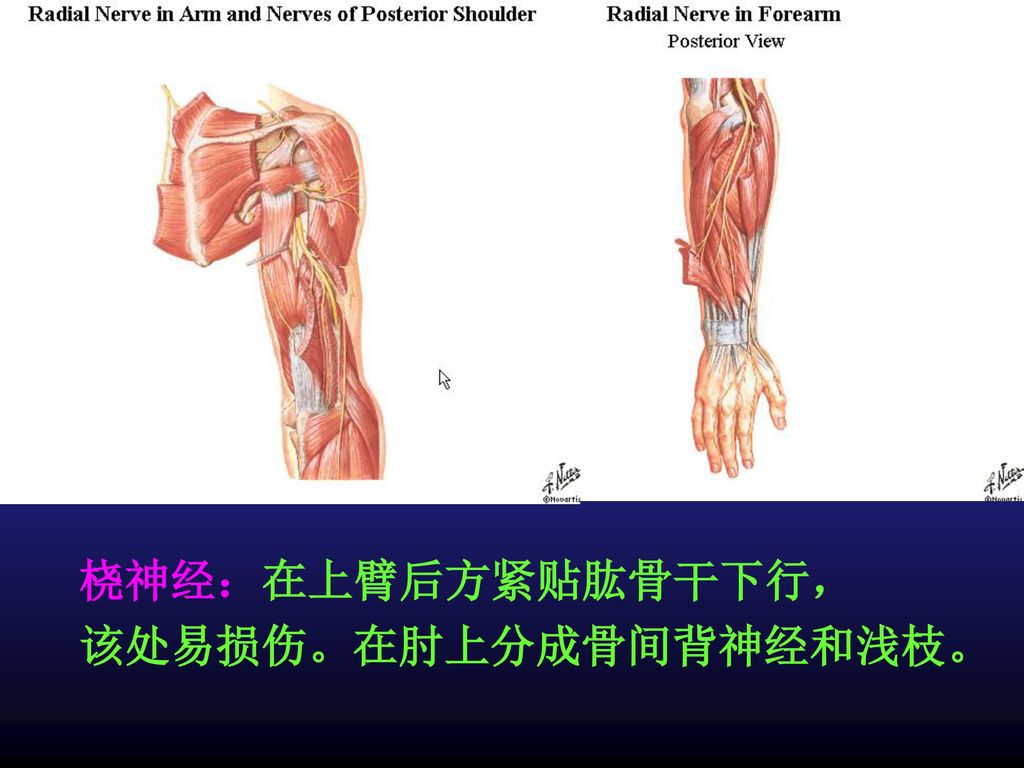 桡神经：在上臂后方紧贴肱骨干下行， 该处易损伤。在肘上分成骨间背神经和浅枝。