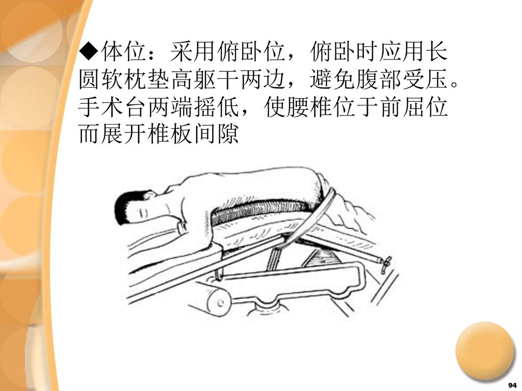 体位：采用俯卧位，俯卧时应用长圆软枕垫高躯干两边，避免腹部受压。手术台两端摇低，使腰椎位于前屈位而展开椎板间隙
