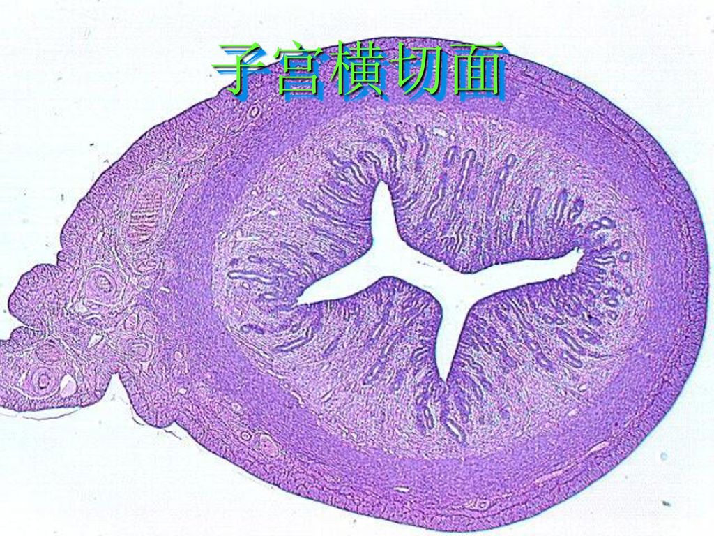 子宫内膜异位症 中国医科大学组胚教研室.