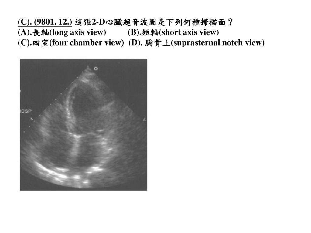 (C). ( ) 這張2-D心臟超音波圖是下列何種掃描面？
