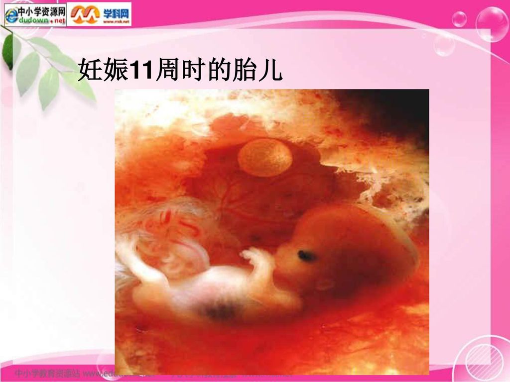 妊娠11周时的胎儿