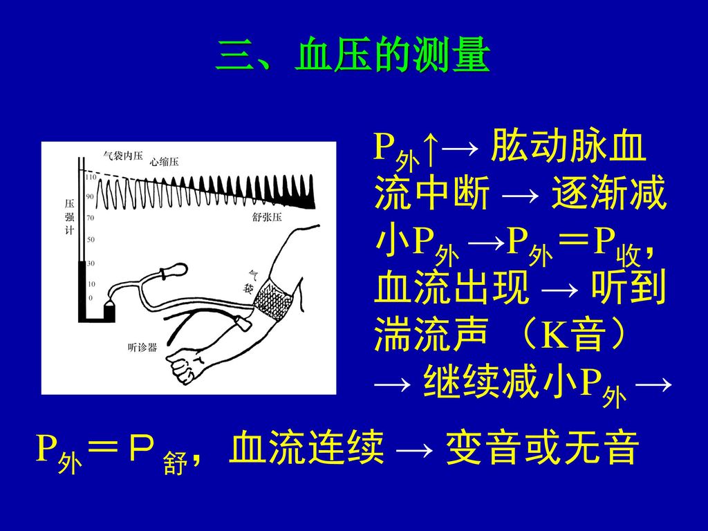 三、血压的测量 流中断 → 逐渐减 小P外 →P外＝P收， 血流出现 → 听到 湍流声 （K音） → 继续减小P外 →