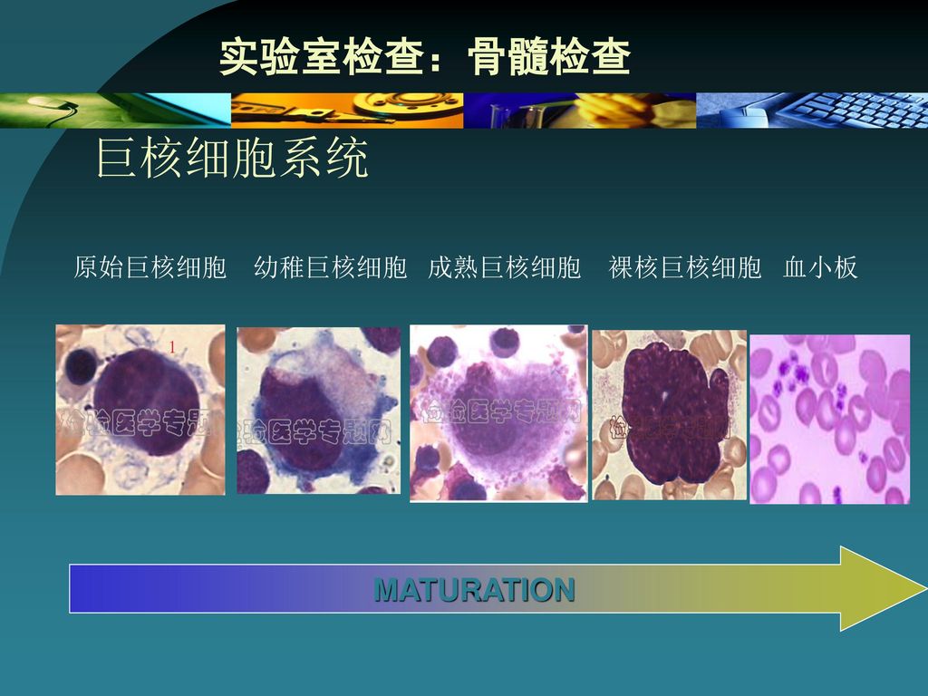 实验室检查：骨髓检查 巨核细胞系统 原始巨核细胞 幼稚巨核细胞 成熟巨核细胞 裸核巨核细胞 血小板 MATURATION