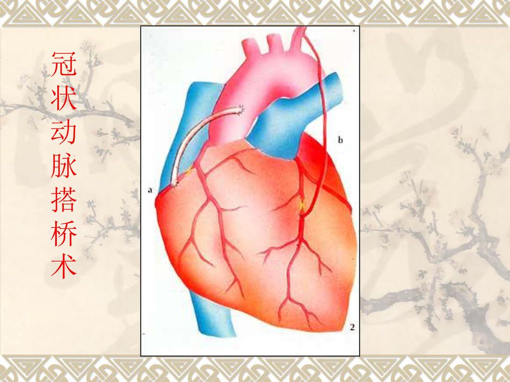 系统解剖学--脉管系统 脉管系统—心. - ppt download