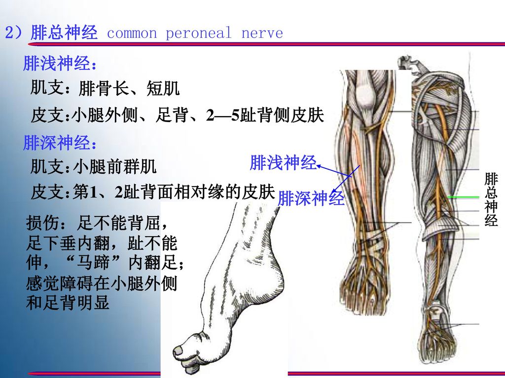 小腿前群肌腓总神经皮支:第1,2趾背面相对缘的皮肤腓深神经损伤:足不