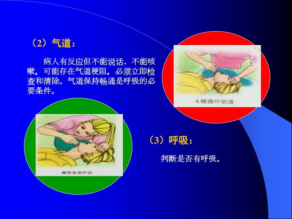 （2）气道： （3）呼吸： 病人有反应但不能说话、不能咳嗽，可能存在气道梗阻，必须立即检查和清除。气道保持畅通是呼吸的必要条件。