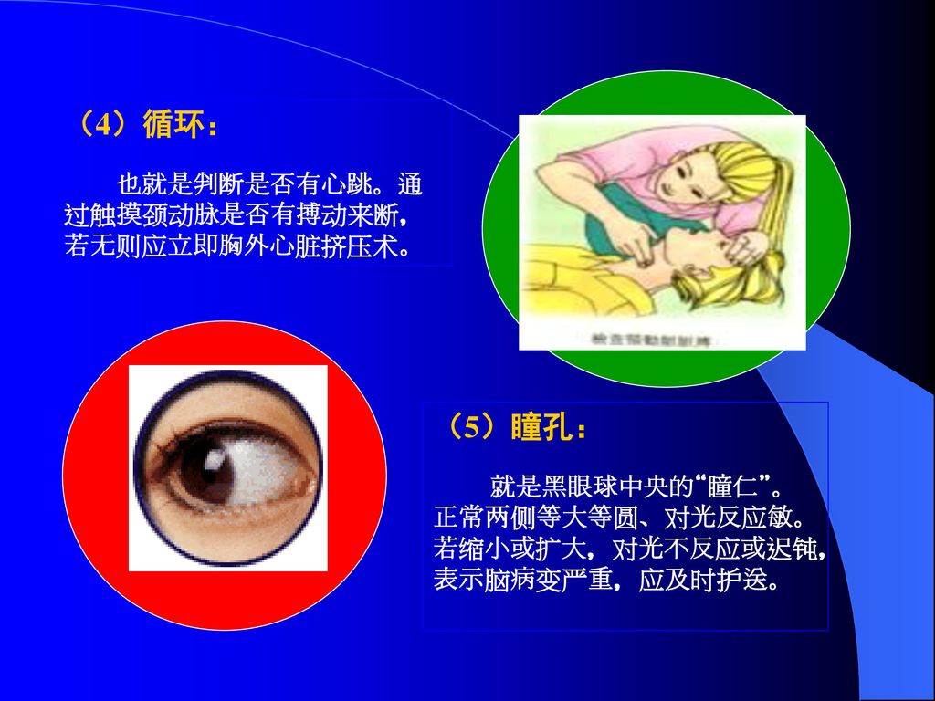 （4）循环： （5）瞳孔： 也就是判断是否有心跳。通过触摸颈动脉是否有搏动来断，若无则应立即胸外心脏挤压术。