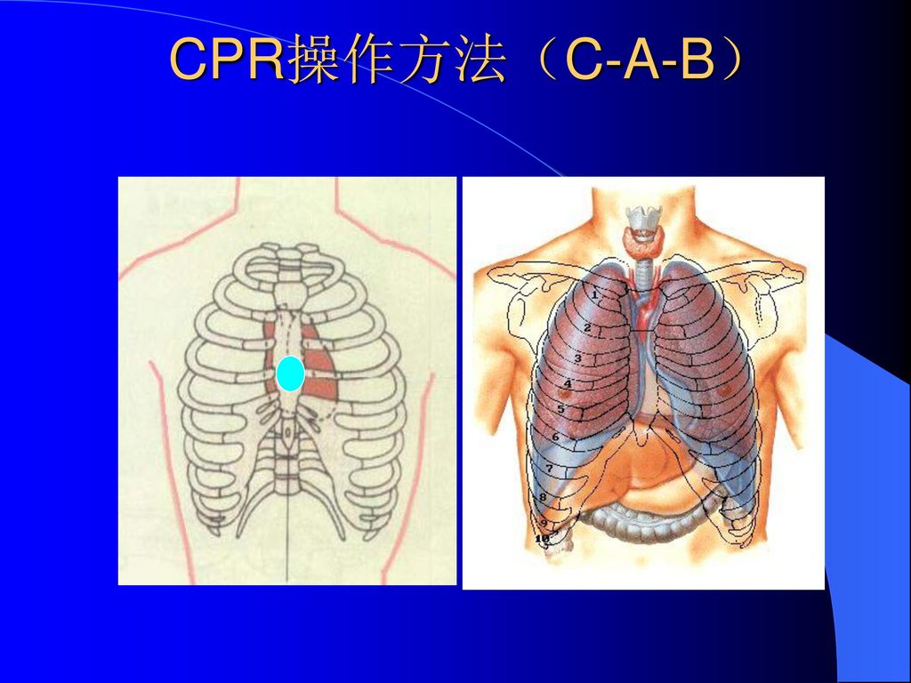 CPR操作方法（C-A-B）