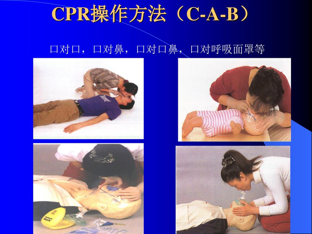 CPR操作方法（C-A-B） 口对口，口对鼻，口对口鼻，口对呼吸面罩等