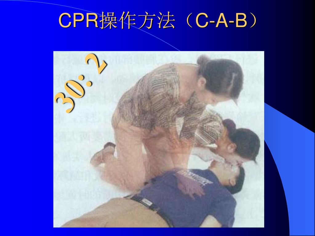 CPR操作方法（C-A-B） 30: 2