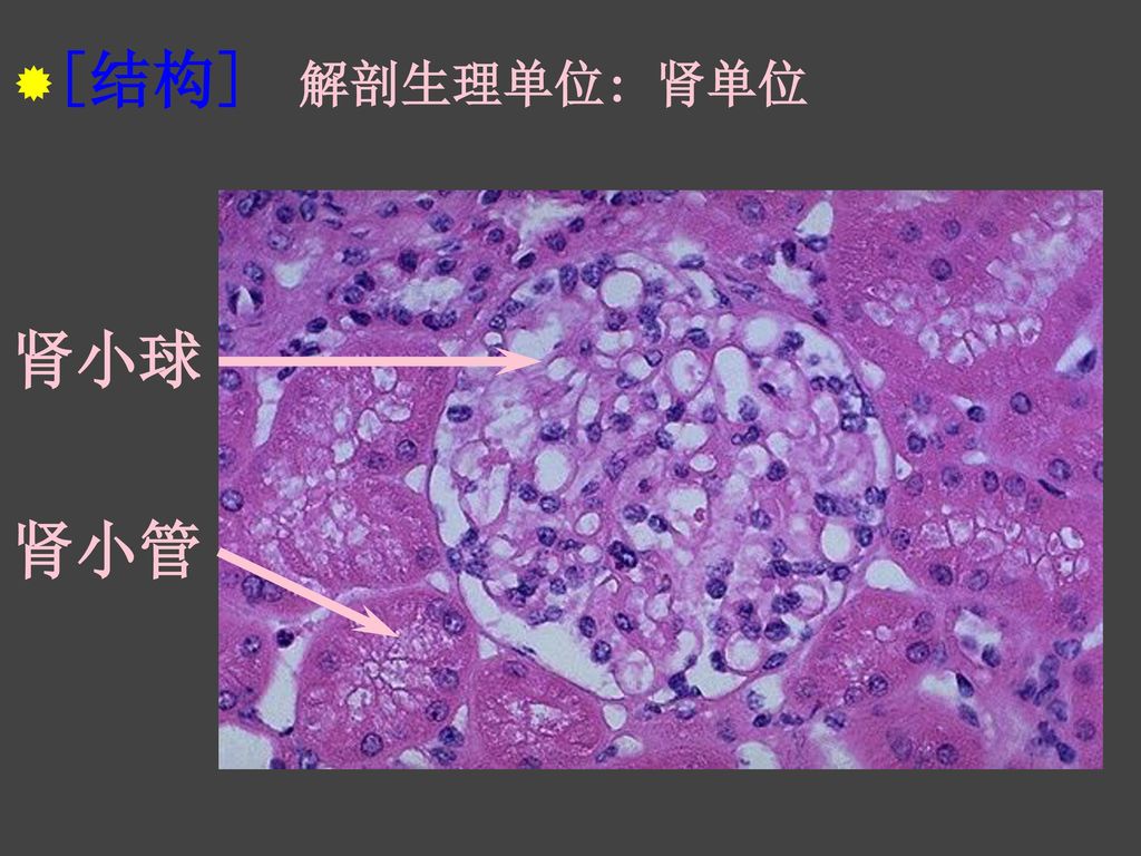 第一节肾小球肾炎 (glomerulonephritis,gn) 病理教研