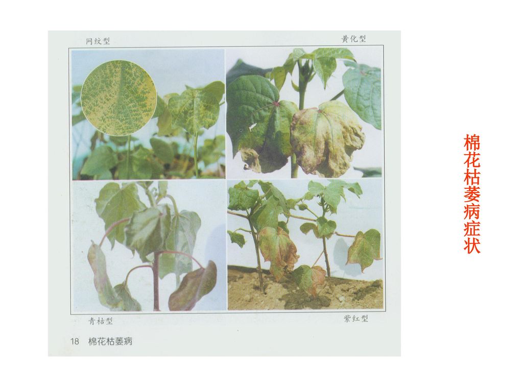 棉花枯萎病cotton fusarium wilt 症状:黄色网纹型:叶片呈黄色网纹状
