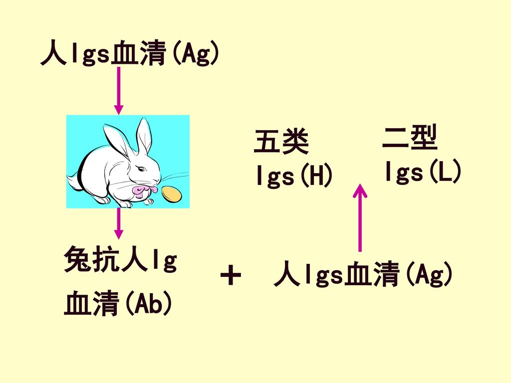 人Igs血清(Ag) 二型Igs(L) 五类Igs(H) 兔抗人Ig 血清(Ab) + 人Igs血清(Ag)