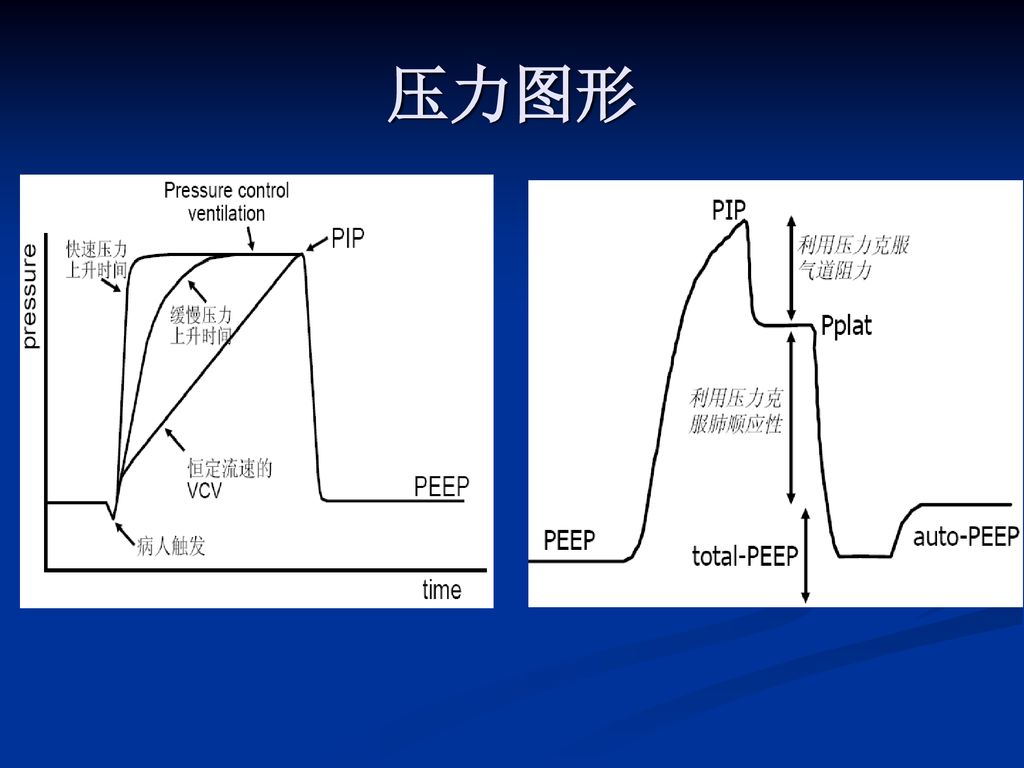 压力图形