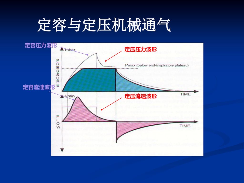 定容与定压机械通气 定容压力波形 定压压力波形 定容流速波形 定压流速波形