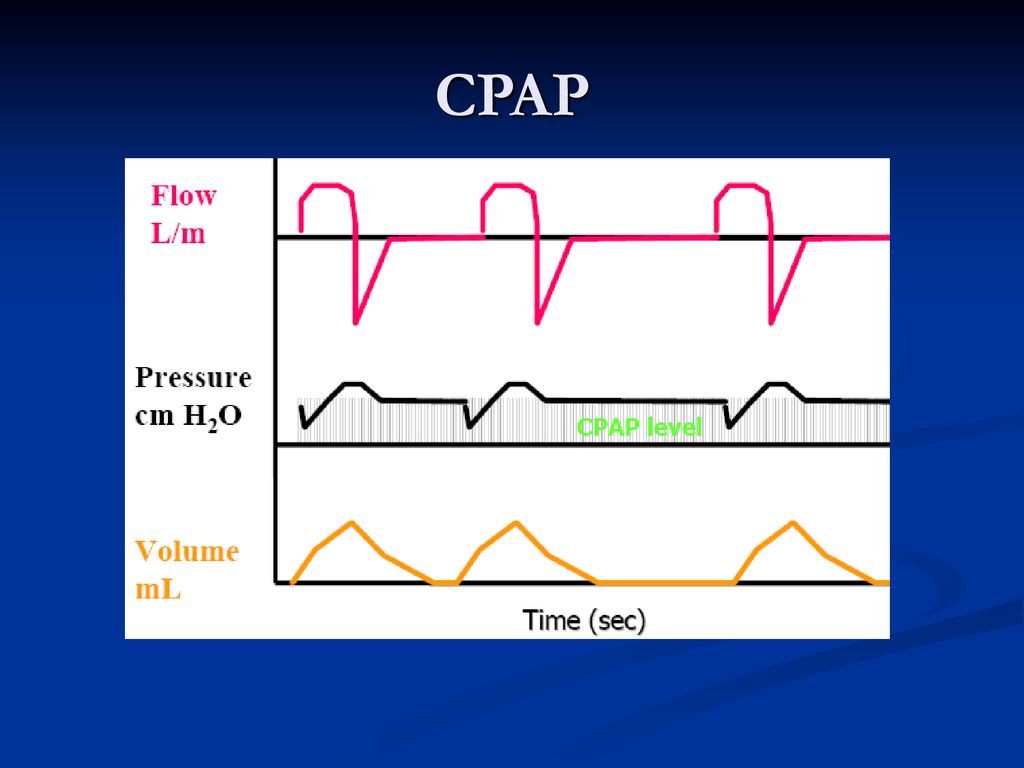 CPAP