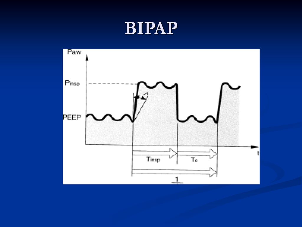 BIPAP