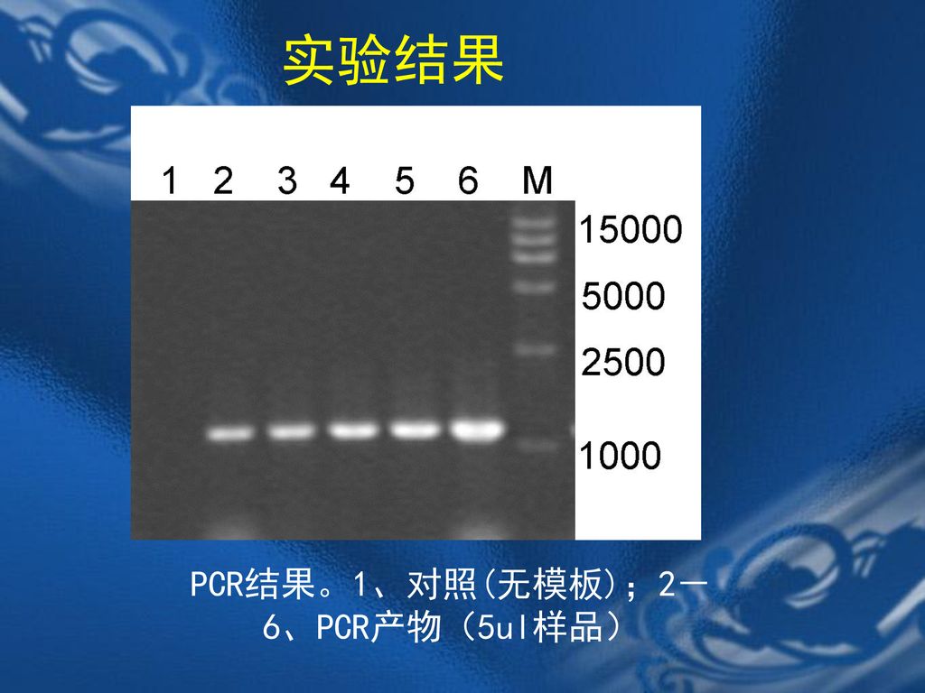 PCR结果。1、对照(无模板)；2－6、PCR产物（5ul样品）